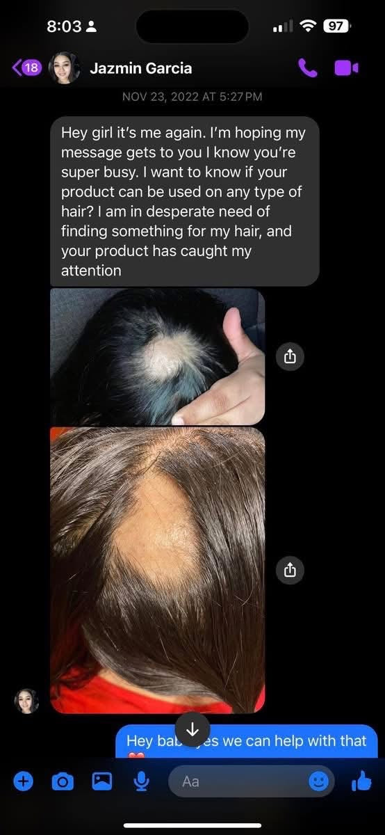 2oz Hair growth oil $5 Sale