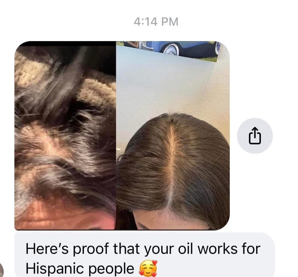 2oz Hair growth oil $5 Sale