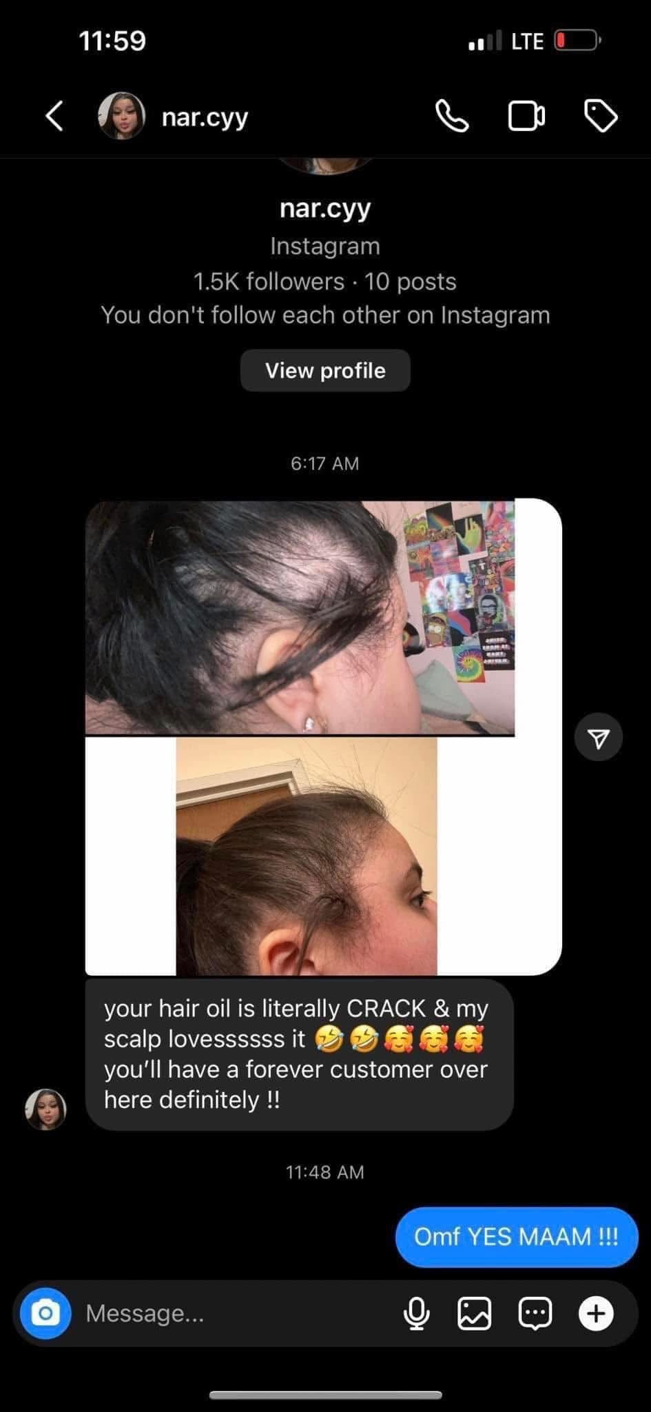 2oz Hair growth oil $5 Sale
